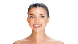 Tan Removal